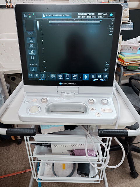 高性能エコー画像観察器のコニカミノルタ製、HS2